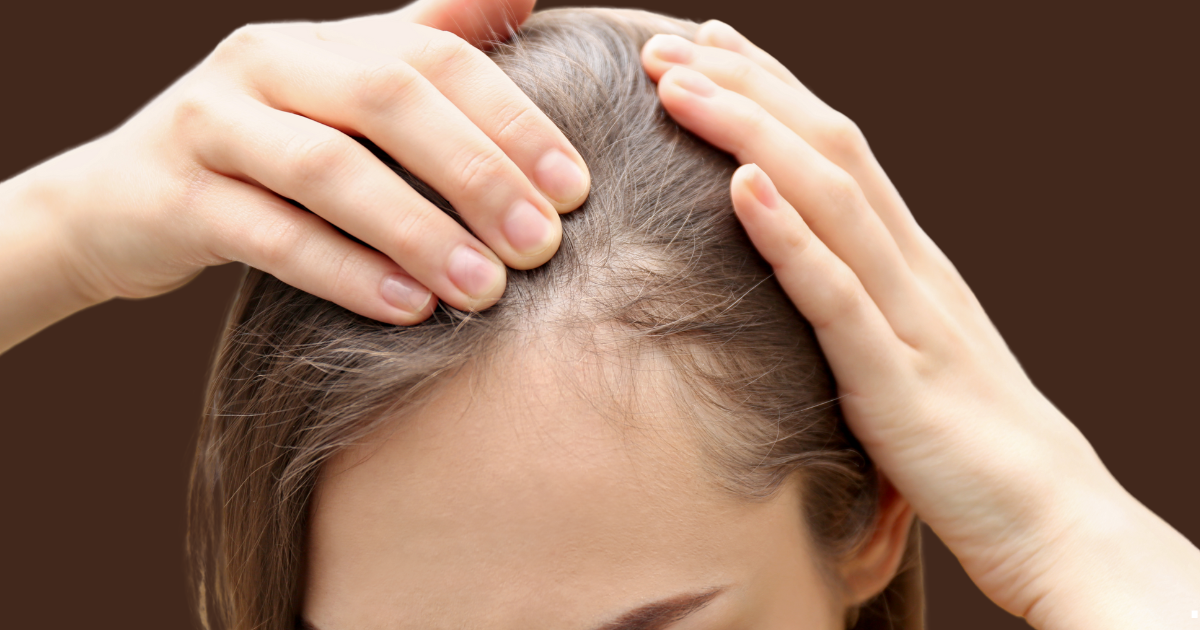 Ozempic e Mounjaro aumentam risco de queda de cabelo em 50%. Estudo revela eflúvio telógeno causado por perda rápida de peso. Saiba como prevenir.