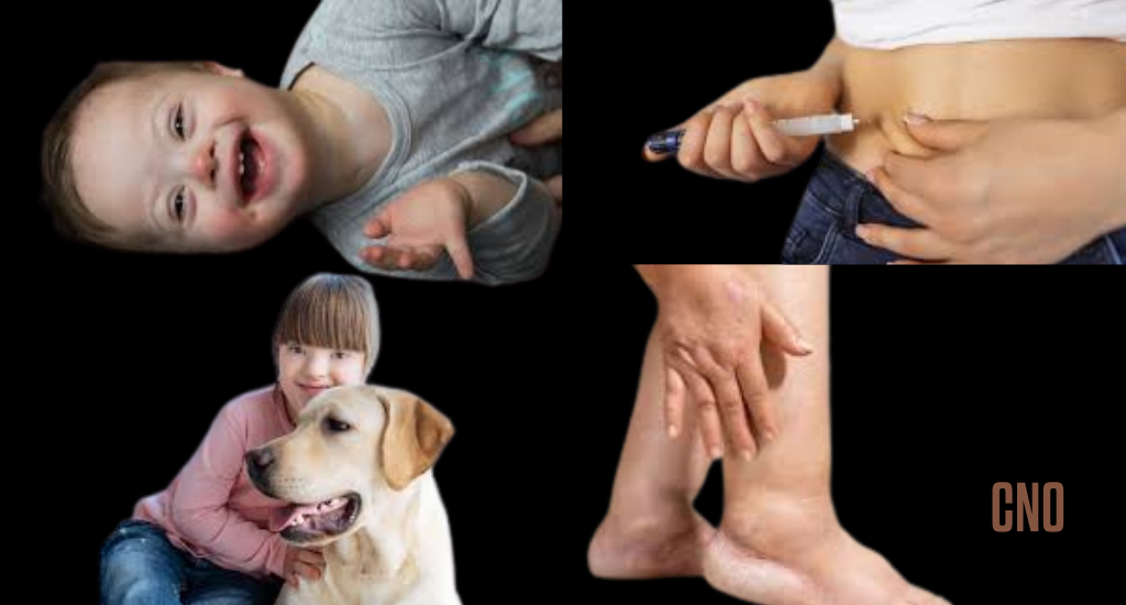 MS oferece informações sobre lipedema e síndrome de Down, mas falha na distribuição de insulina. Alerta de raiva animal com 9 casos registrados.